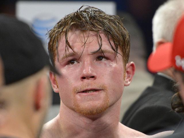Saul Alvarez is fancied to beat Miguel Cotto inside the distance